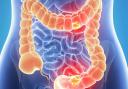 Bowel Cancer UK are encouraging people to do something active every day as part of our ActiveApril campaign