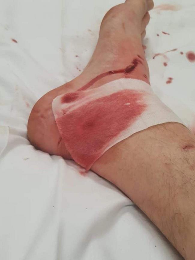 A photo showing some of the injuries suffered by the victim