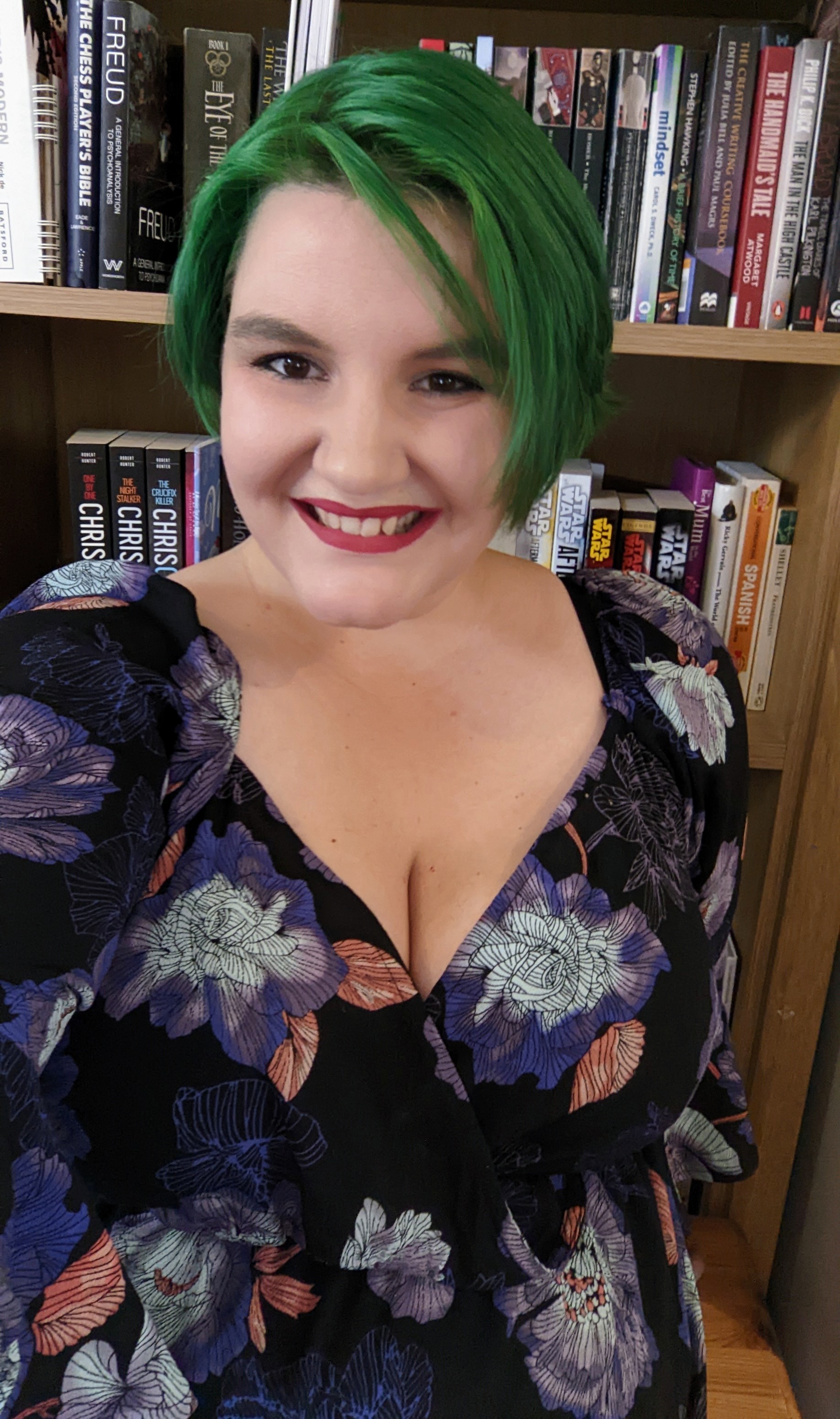 Rebecca McDowall with green hair for Go Green for Dystonia, which runs for the month of September